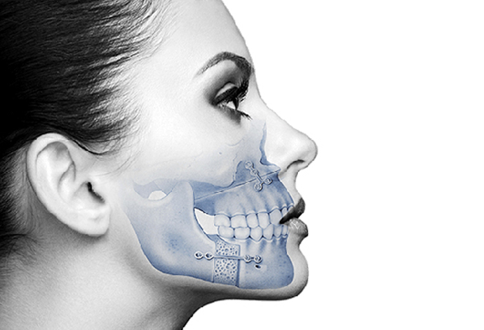 chirurgie dentara sibiu